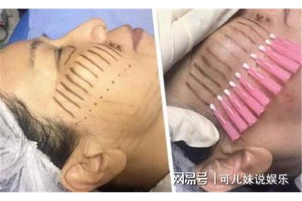 埋线多久可以化妆