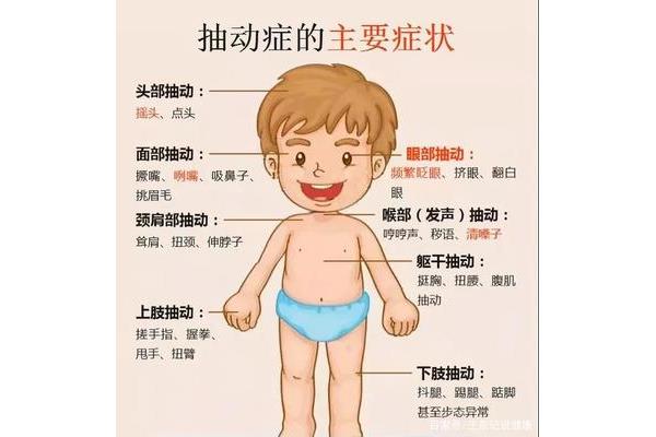 抽动症可以自愈吗